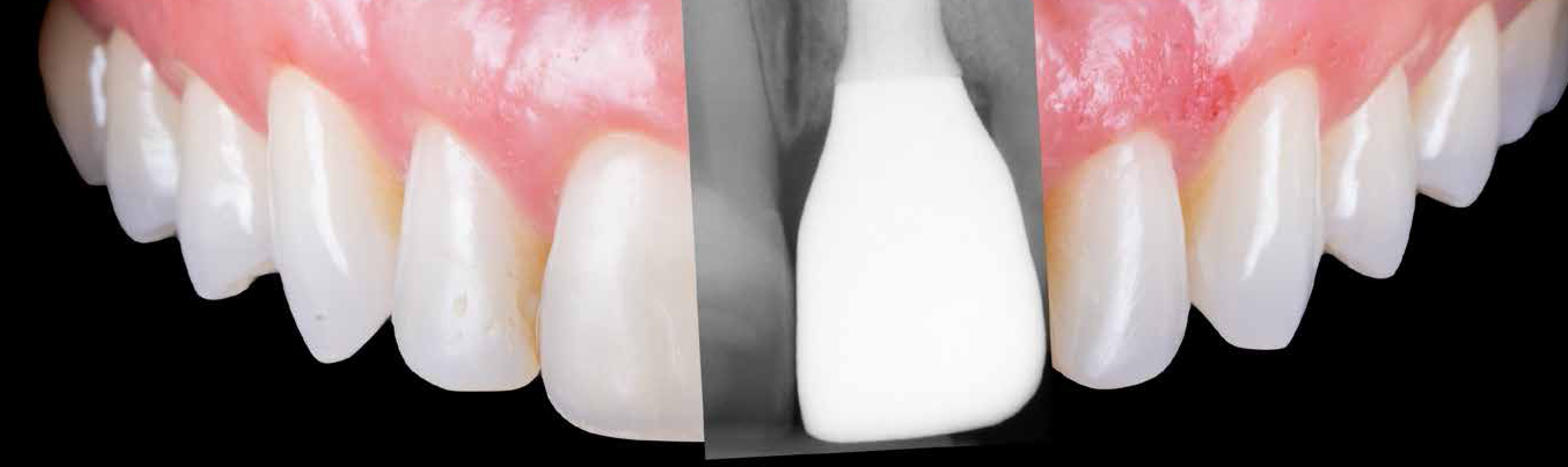 It's Simple. Enroll Now!