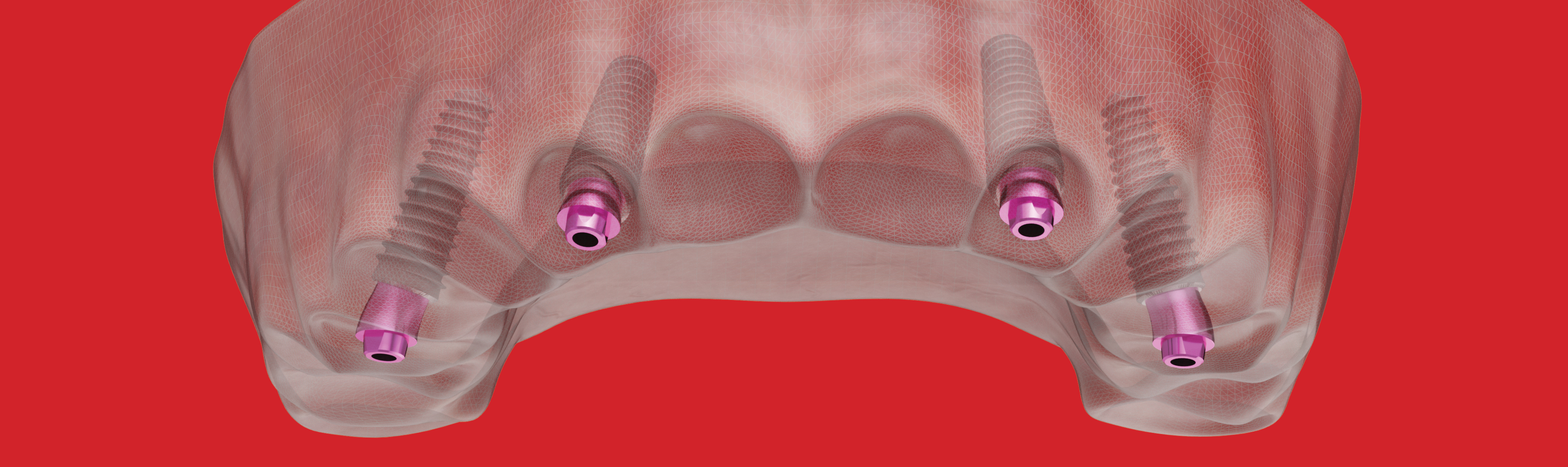 It's Simple. Enroll Now!