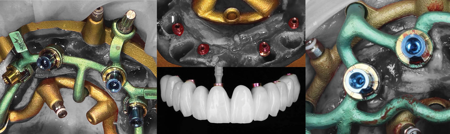 It's Simple. Enroll Now!