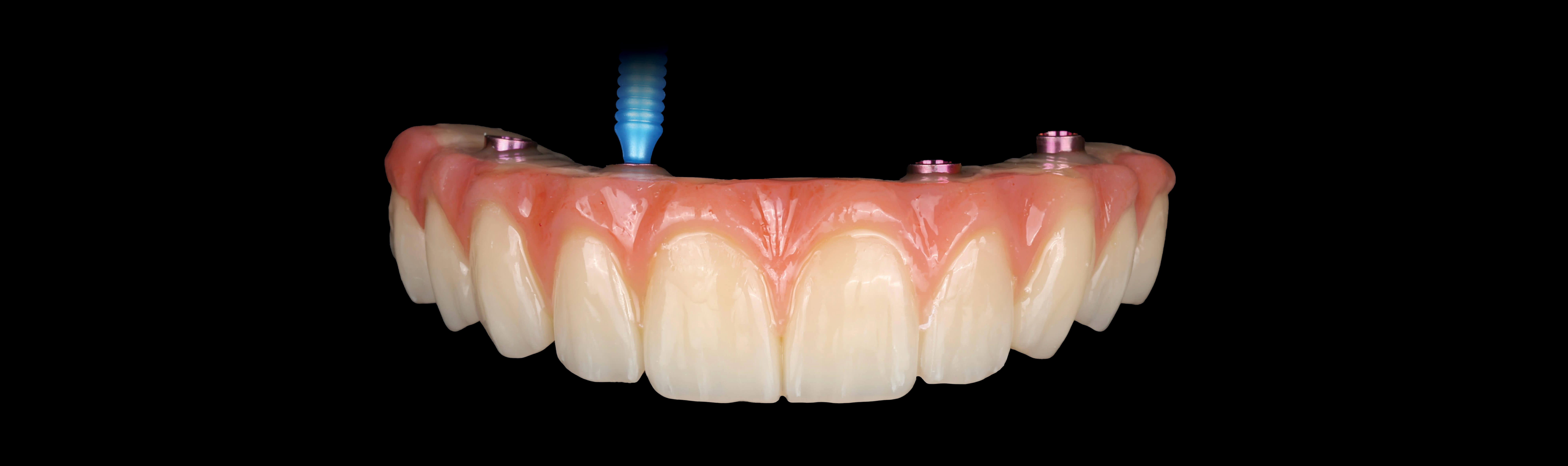 It's Simple. Enroll Now!