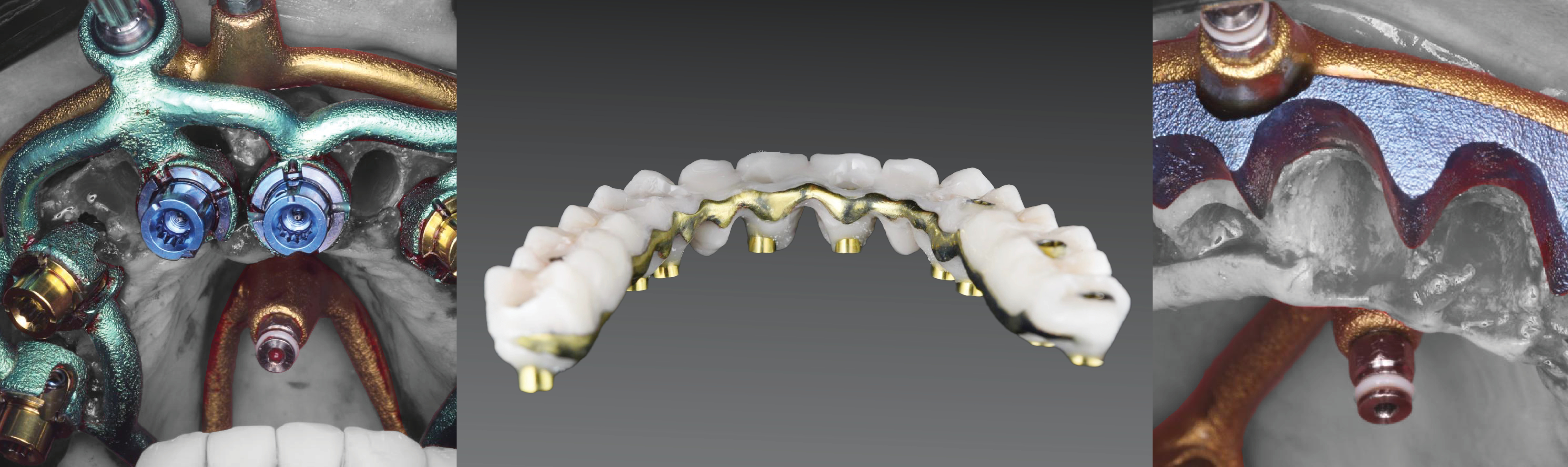 It's Simple. Enroll Now!