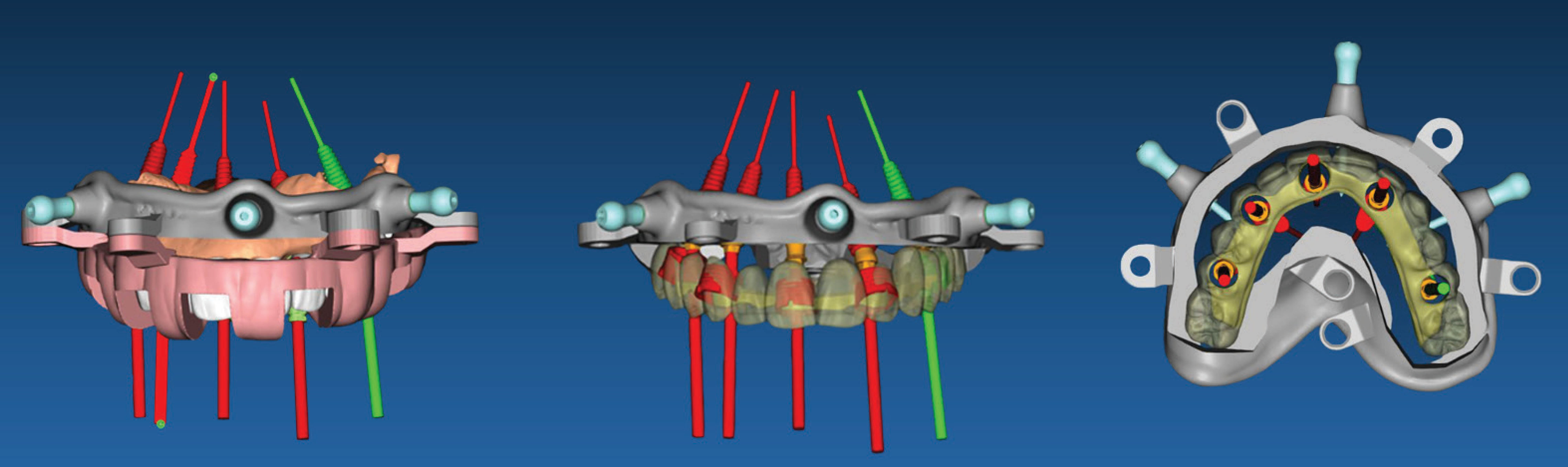 It's Simple. Enroll Now!