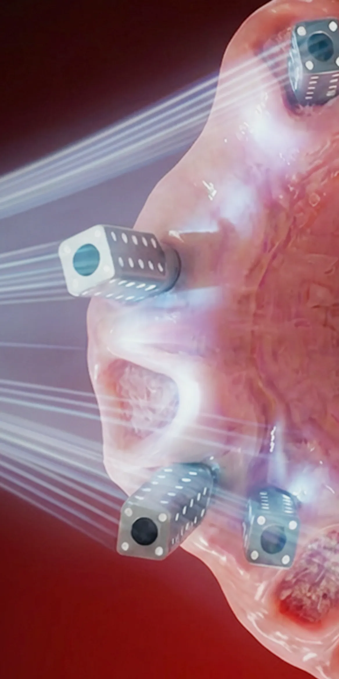 Digital Full Arch Protocol & the Photogrammetry’s Role in Full Arch Success