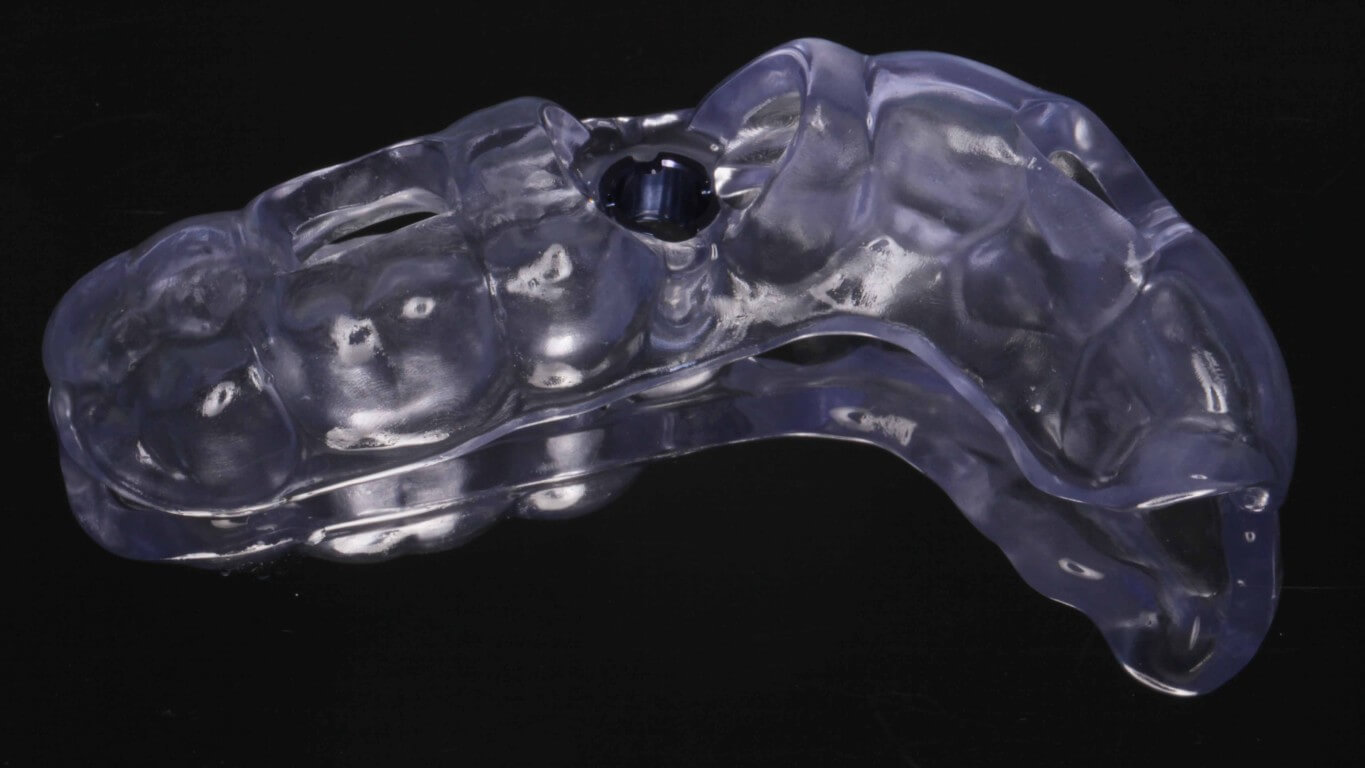 Additional media for Full Arch Surgery with Dr. Khartic Patel