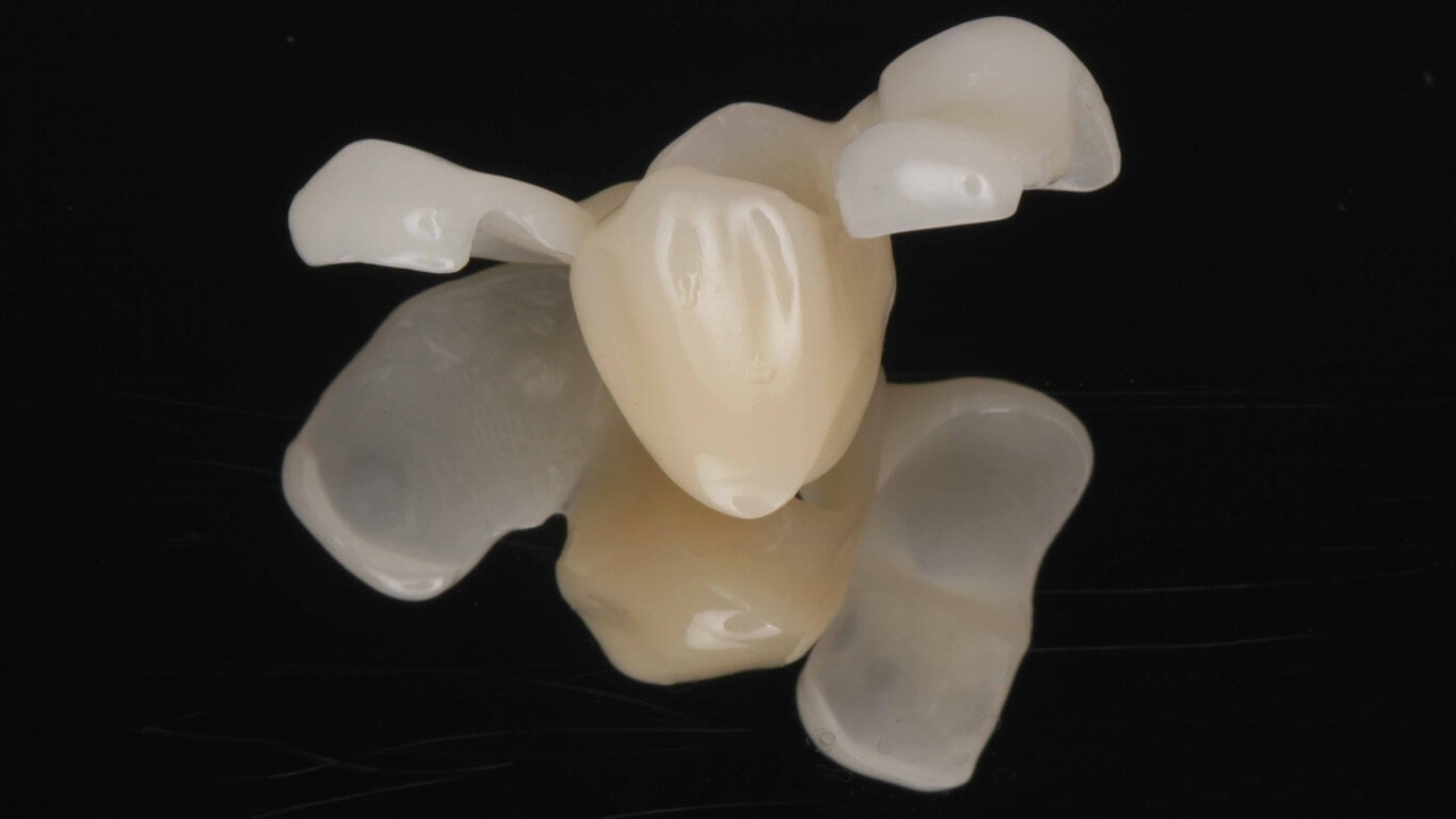 Additional media for Full Arch Surgery with Dr. Khartic Patel