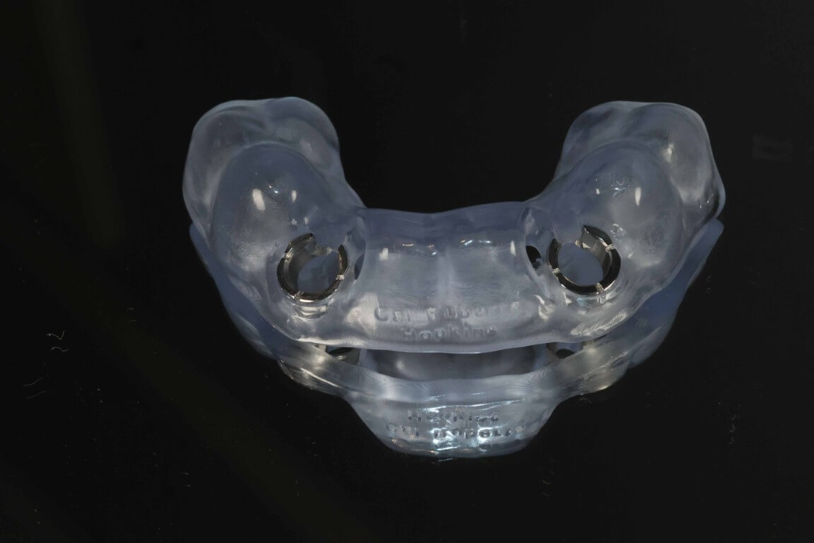 Additional media for Profilo Guided Surgery with Dr. Simon Chard