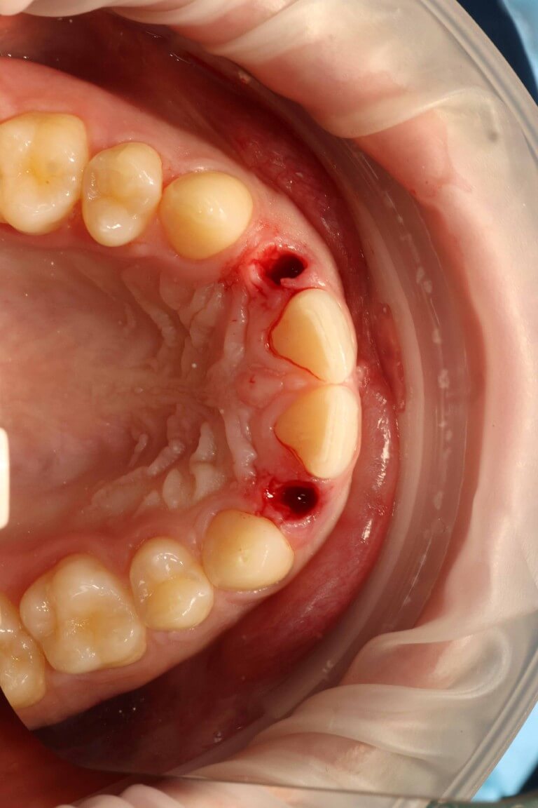 Gallery image for Profilo Guided Surgery with Dr. Simon Chard