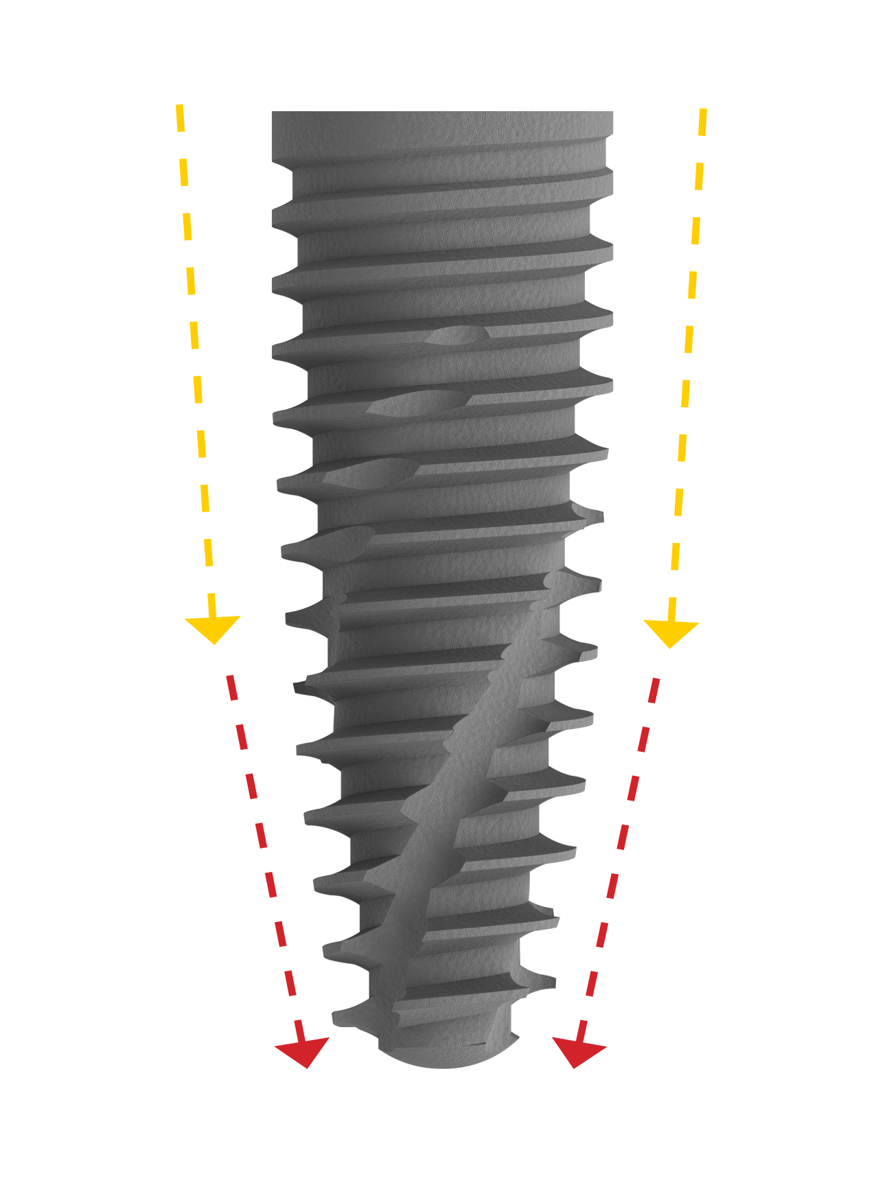 High Primary Stability.<br/>  Thanks to the P-3 Inserta’s unique tapered morphology and self-tapping design, <span class="text-primary-500">higher initial stability can be attained in any compromised bone situation</span> and post extractive sites